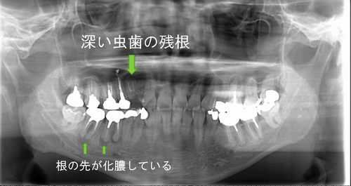 症例写真