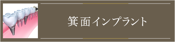 箕面インプラント特徴