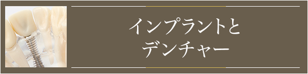 インプラントとデンチャー