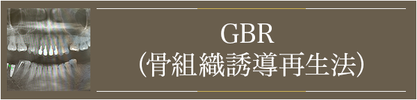 GBR(骨組織誘導再生法)