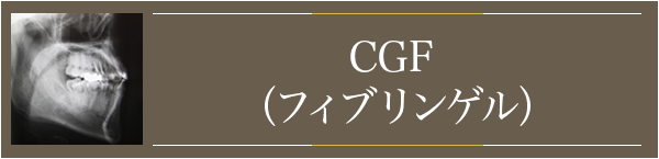 CGF（フィブリンゲル）